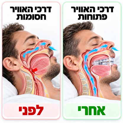 התקן נחירות snoreaway