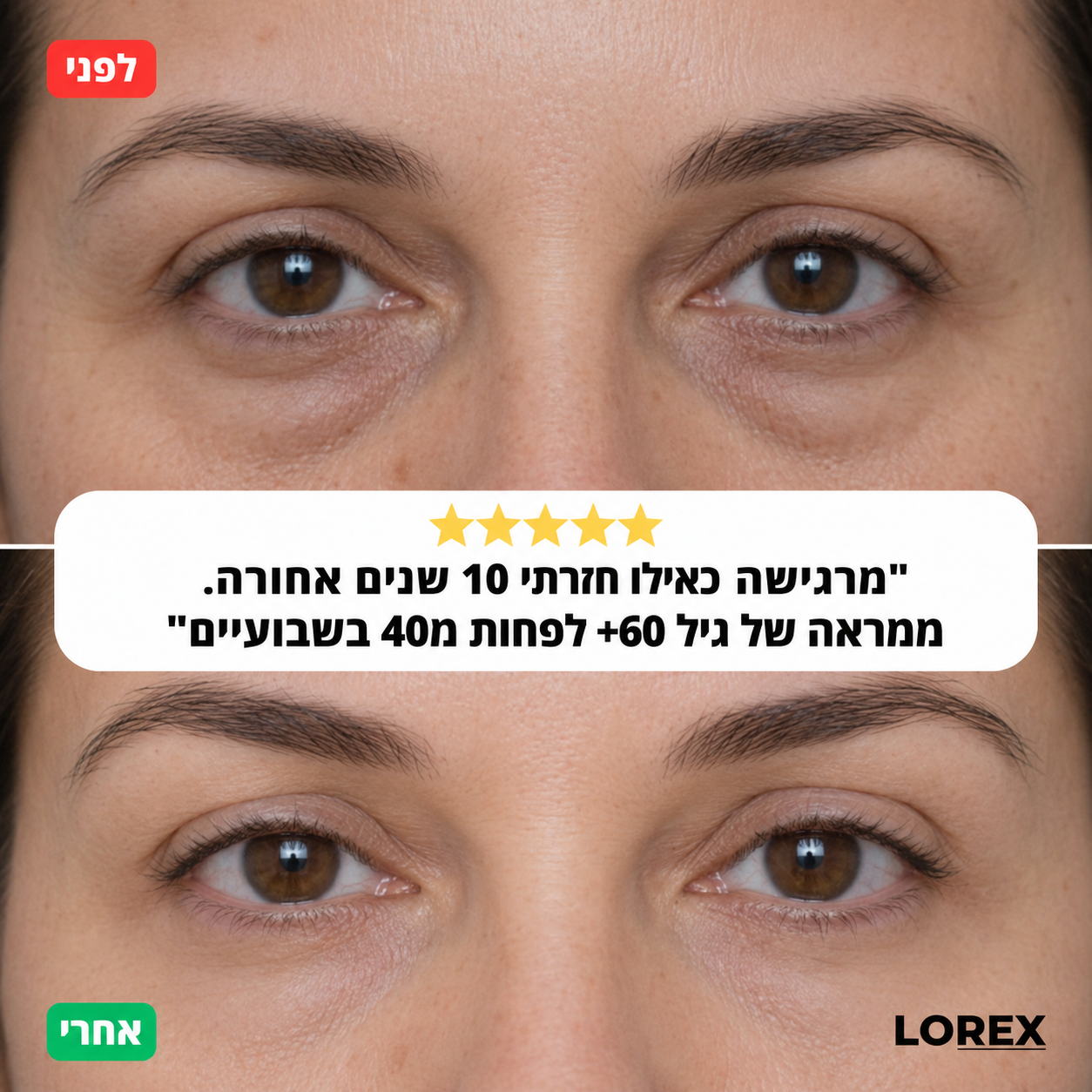 סרום לשיקום העיניים לנשים - Lorex