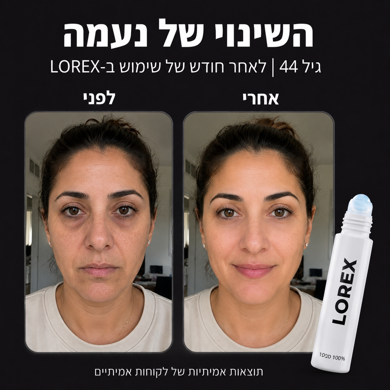 סרום לשיקום העיניים לנשים - Lorex
