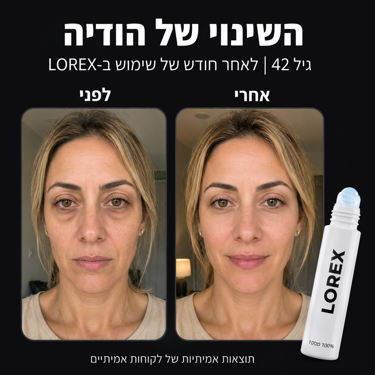 סרום לשיקום העיניים לנשים - Lorex