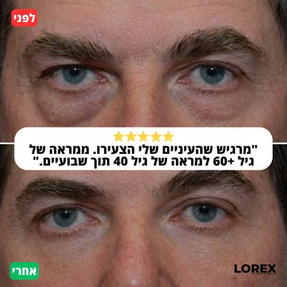 סרום לשיקום העיניים - Lorex
